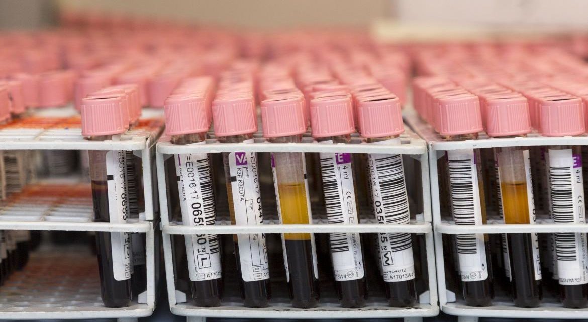 El macromaratón Madrid Dona Sangre alcanza las 5.725 donaciones en una semana